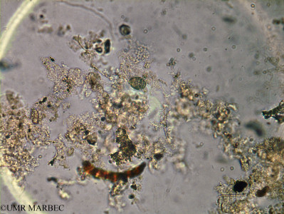 phyto/Brazilian_Amazon_coast/Amazomix_station_10/AMAZOMIX September 2021/Corythodinium constrictum (Am_ST10_r1_surf_cory_cf_tesselqtum240821_002)(copy)_thumb.jpg